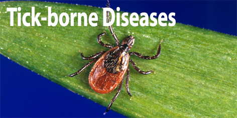 Tick-Borne Diseases