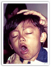 Difficulty of breathing in a young boy with diphtheria Difficulty of breathing in a young boy with diphtheria
