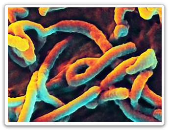 Maladie  Ebola