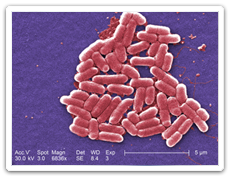 Escherichia coli O157:H7 (E. coli)