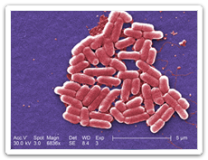 Escherichia Coli O157 E Coli Health Seniors And Active Living Province Of Manitoba