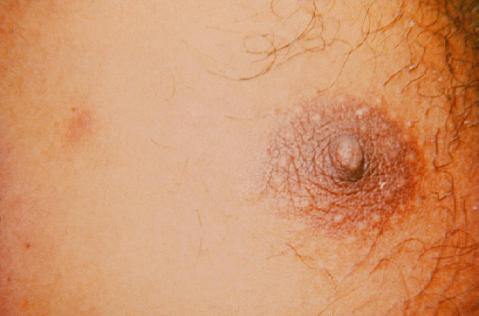 Rash 101: The Most Common Types of Skin Rashes