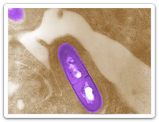 Listériose (Listeria monocytogenes)