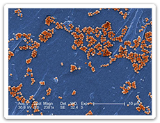 Staphylococcus aureus résistant à la méthicilline (SARM) | Santé ...