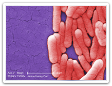 Salmonellose (Salmonella spp.)