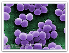 What is Staphylococcus Aureus?