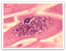 toxoplasmosis (toxoplasma gondii)