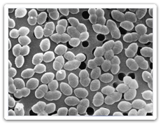 Vancomycin Resistant Enterococci (VRE)